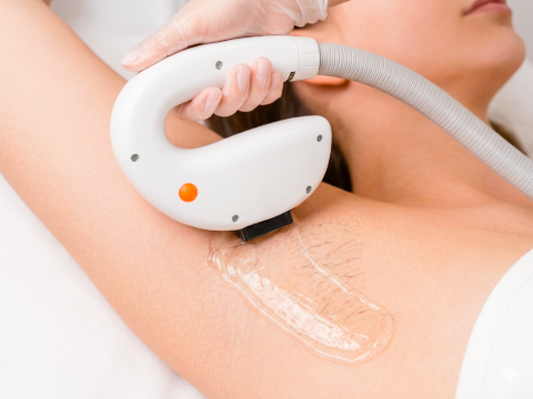 IPL Treatment